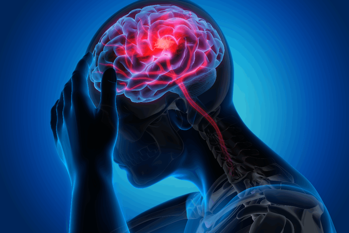 Neurology Image