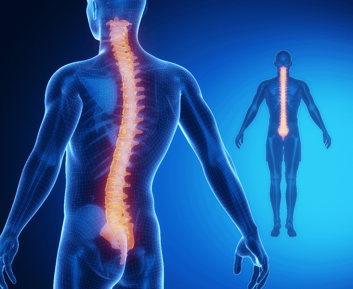 Spinal Cord Stimulation in NYC  Sports Injury & Pain Management